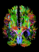 Brain image